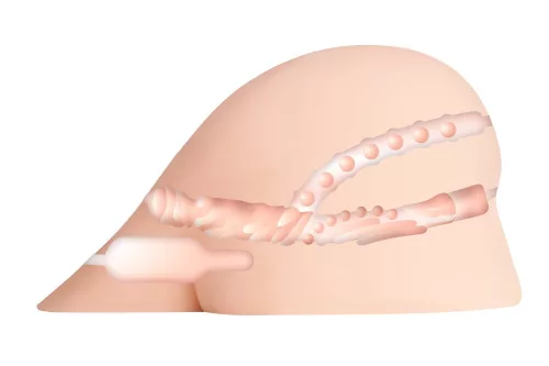 XXX To-Go con CONTROLLER I